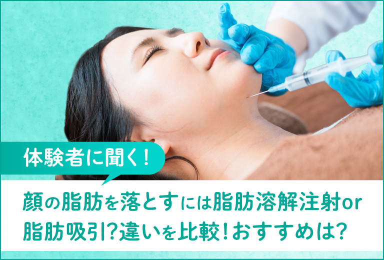 【体験者に聞く】顔の脂肪を落とすには脂肪溶解注射or脂肪吸引？違いを比較！おすすめは？