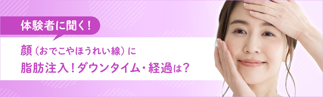 【体験者に聞く！】顔（おでこやほうれい線）に脂肪注入！ダウンタイム・経過は？